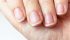 Fingernail Health Can Hold Clues to Internal Health. What Do Yours Say?