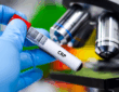 The Overlooked Blood Test That Could Save Your Life