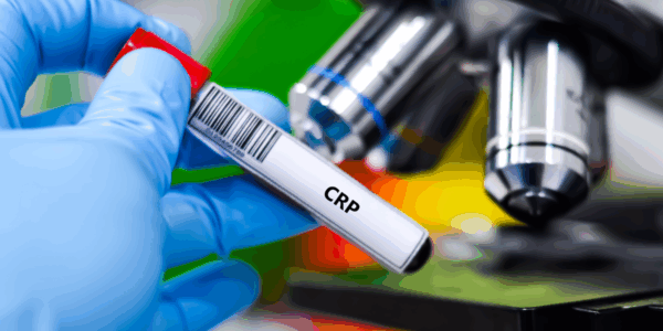 The Overlooked Blood Test That Could Save Your Life