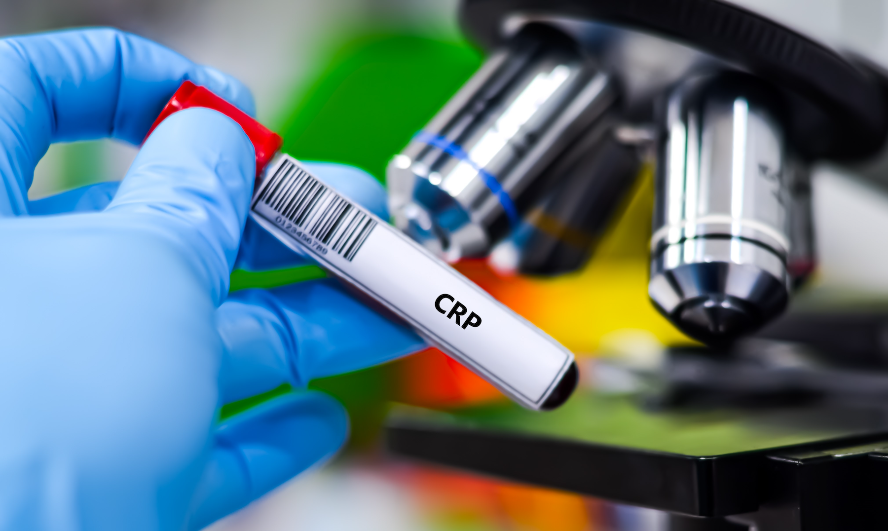 The Overlooked Blood Test That Could Save Your Life